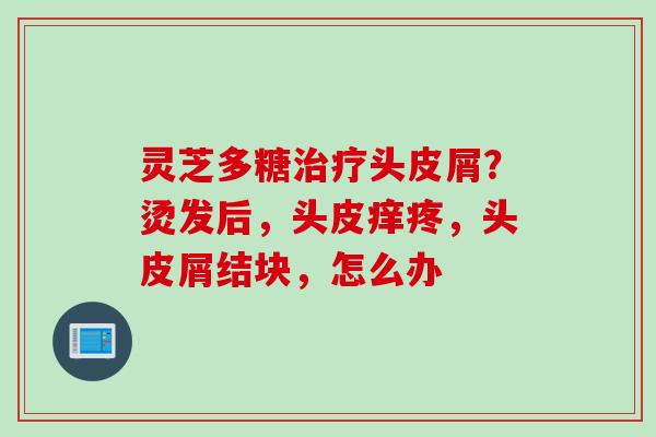 灵芝多糖治疗头皮屑？烫发后，头皮痒疼，头皮屑结块，怎么办
